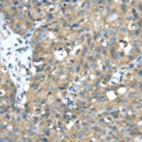 兔抗TMED1多克隆抗体