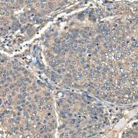 兔抗FCGR1A多克隆抗体