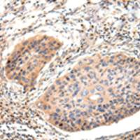 兔抗Lambda Light chain多克隆抗