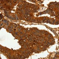 兔抗CEACAM21多克隆抗体