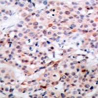 兔抗BCL2(Phospho-Thr56)多克隆抗体