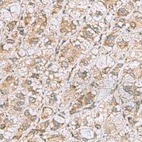 兔抗CCDC134多克隆抗体