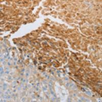 兔抗RTN4多克隆抗体