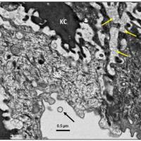 组织外泌体组学解决方案