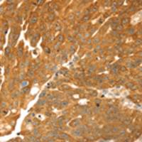 兔抗TMEFF2多克隆抗体