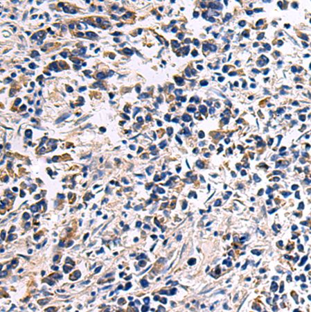 兔抗DRGX多克隆抗体