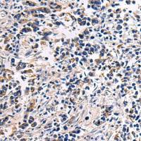 兔抗DRGX多克隆抗体