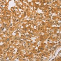 兔抗CEBPB多克隆抗体