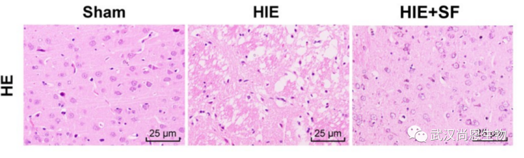 【文献解读】七氟醚通过调节G9a表达缓解缺氧缺血性脑病研究 • PC-12（高分化）细胞