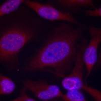 兔抗MAPK8 MAPK9 MAPK10(phospho-Thr183 Tyr185)多克隆抗体