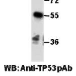 Anti TP53 Rabbit Polyclonal Antibody