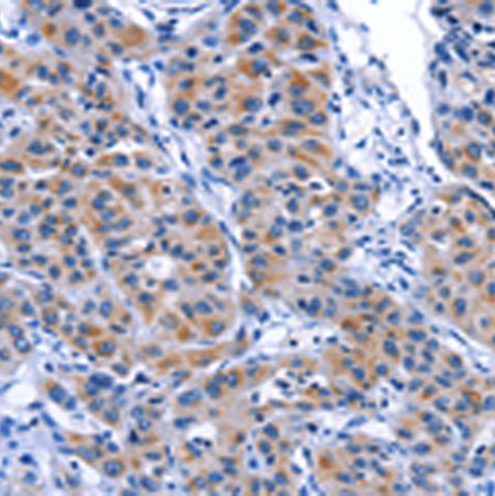 兔抗MYH1多克隆抗体