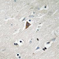 兔抗PDPK1(Phospho-Tyr9)多克隆抗体