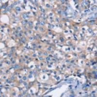 兔抗DMD多克隆抗体