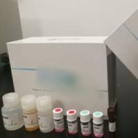 人单核细胞趋化蛋白-1(MCP-1)检测试剂盒（ELISA 法