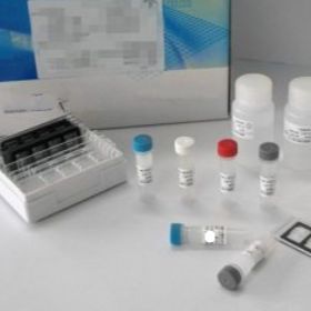 人血栓调节蛋白(TM)ELISA Kit