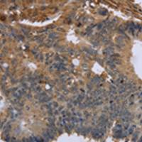 兔抗FLNA多克隆抗体