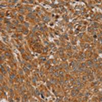 兔抗PLEKHG6多克隆抗体