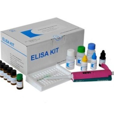 人抗巨细胞病毒抗体IgM(anti-CMV IgM)ELISA Kit 