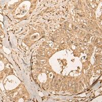 兔抗UTP11多克隆抗体