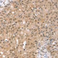 兔抗TRIM35多克隆抗体