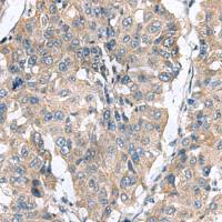 兔抗CLEC1B多克隆抗体