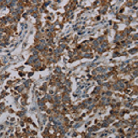 兔抗CFLAR多克隆抗体