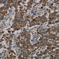 兔抗CFLAR多克隆抗体