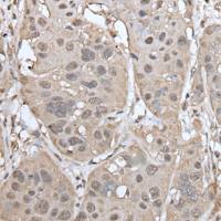 兔抗UBASH3A多克隆抗体