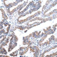 兔抗XKR4多克隆抗体