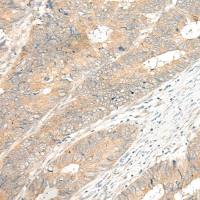 兔抗GPR12多克隆抗体