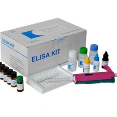 小鼠晚期糖基化终末产物(AGEs)ELISA Kit