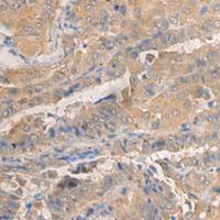 兔抗AGAP3多克隆抗体