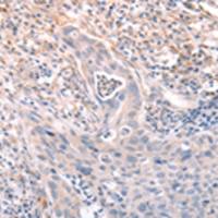 兔抗A4GNT多克隆抗体