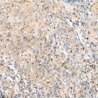 兔抗EIF3L多克隆抗体