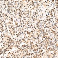 兔抗ASPSCR1多克隆抗体