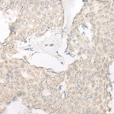 兔抗SLC22A24多克隆抗体