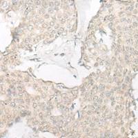 兔抗SLC22A24多克隆抗体