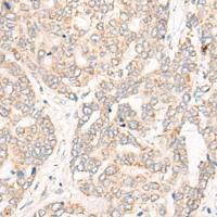 兔抗CREB3L2多克隆抗体