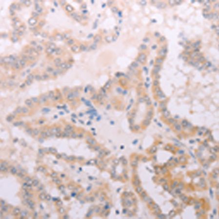 兔抗TPO多克隆抗体