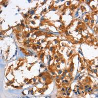 兔抗HK1/HK2多克隆抗体