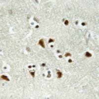 兔抗TUBGCP6多克隆抗体