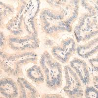 兔抗FAM98A多克隆抗体