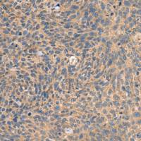 兔抗EIF1AX多克隆抗体