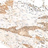 兔抗POLR1D多克隆抗体