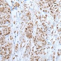 兔抗ZNF302多克隆抗体