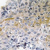 兔抗BCAR1(Ab-410)多克隆抗体