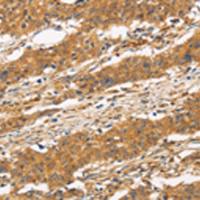 兔抗CD22多克隆抗体