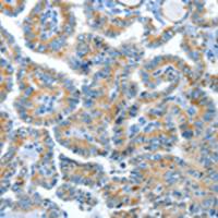 兔抗COG1多克隆抗体