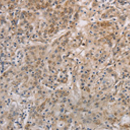 兔抗ESRRG多克隆抗体